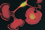 Protein Biology