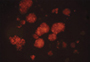 24-Well Anoikis Assay
