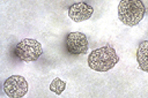 Cell Transformation