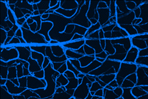 Lipoprotein Lipase (LPL) Activity Assay