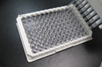 Homocysteine ELISA Kit